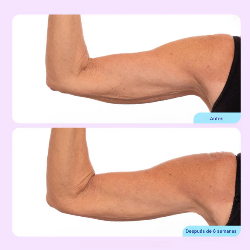Crema Esculpidora y Tonificante para Brazos🎁 ENVIO GRATIS 🎁