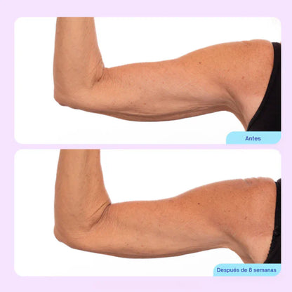 Crema Esculpidora y Tonificante para Brazos🎁 ENVIO GRATIS 🎁